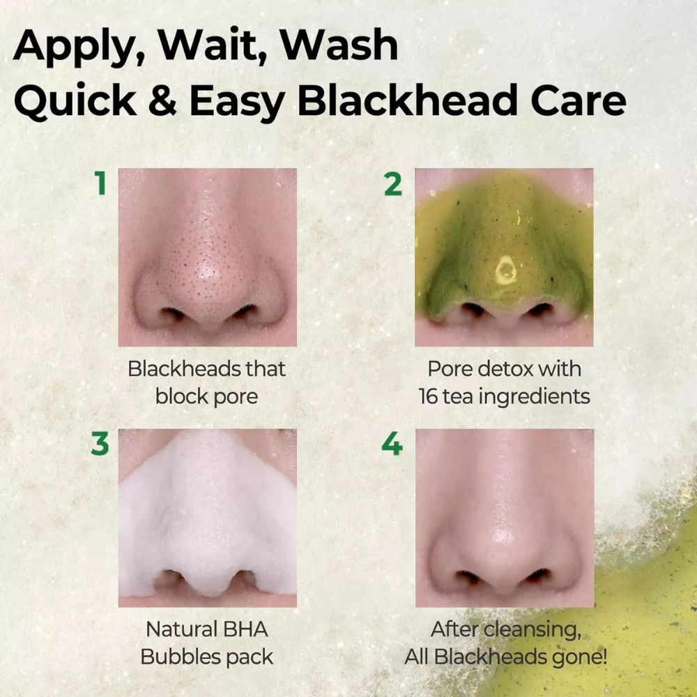 Some By Mi Bye Bye Blackhead 30 Days Miracle Green Tea Tox Bubble Cleanser 2