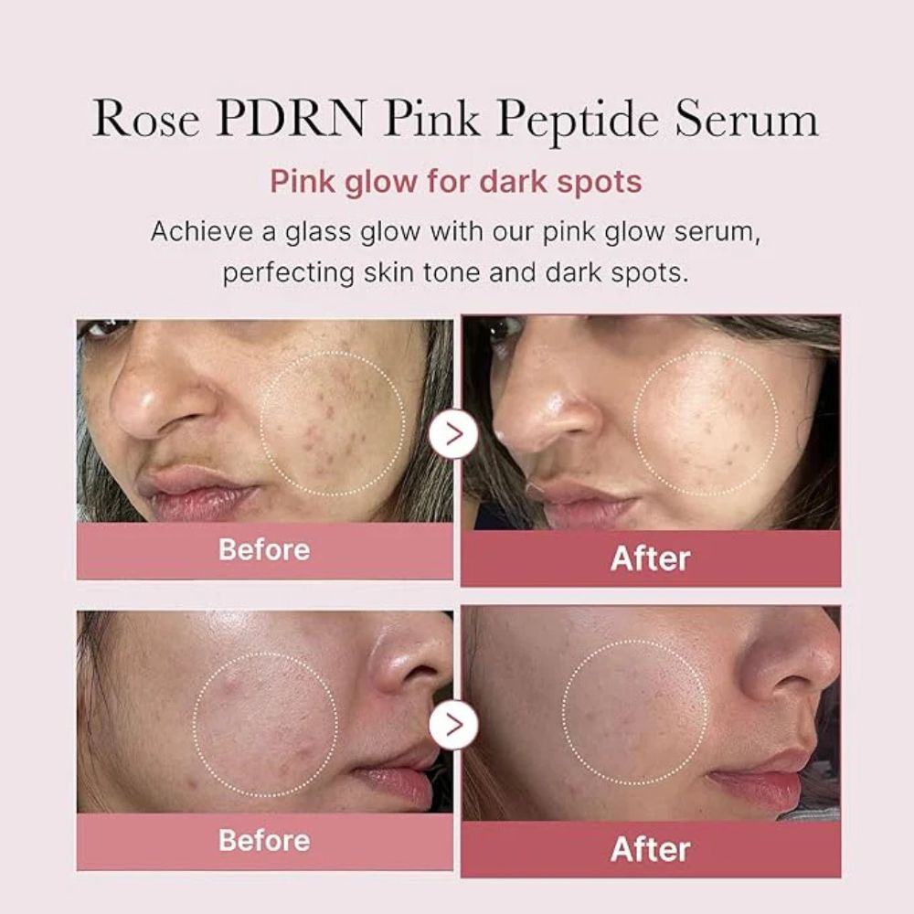 Medicube – PDRN Pink Peptide Serum