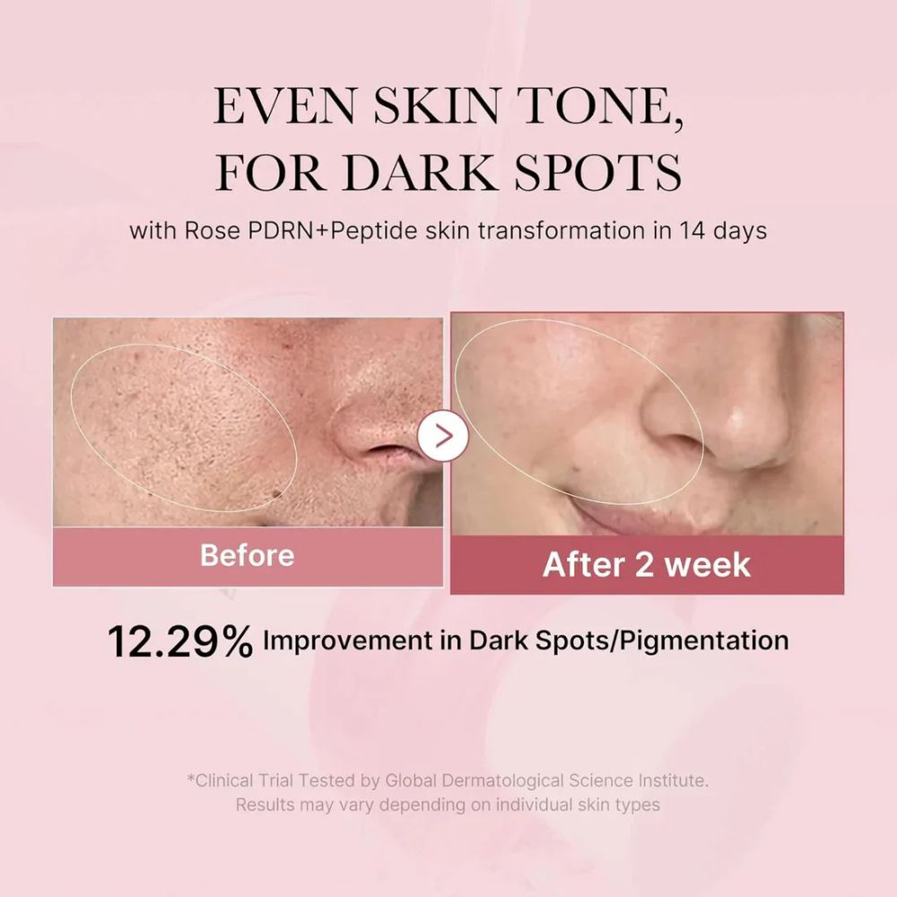 Medicube PDRN Pink Niacinamide Milky Toner 150ml