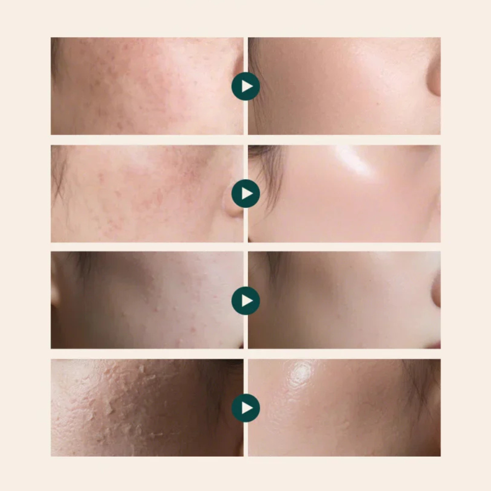 Dr. Reju-All Advanced PDRN Rejuvenating Cream