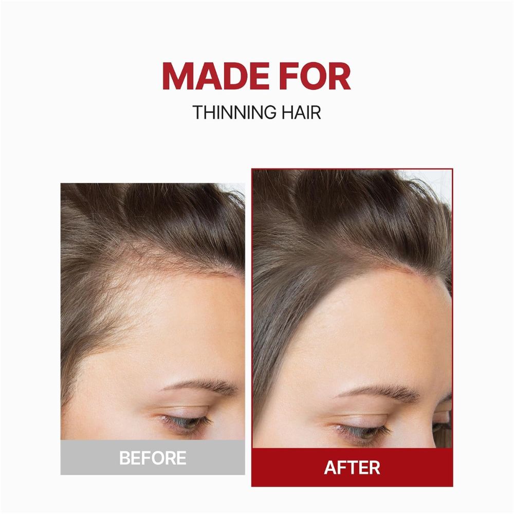 KUNDAL Scalp Care Hair Loss Relief Tonic