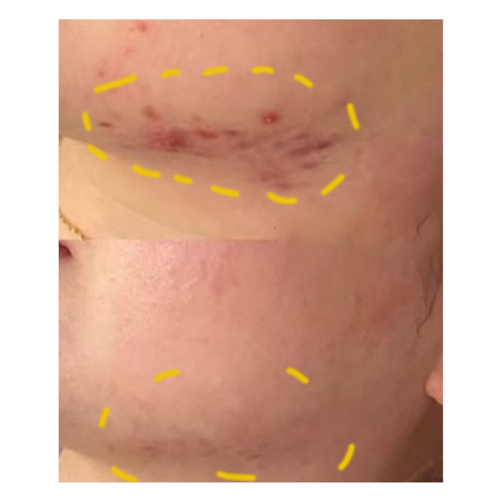 P.CALM Turmeric BHA Bubble Deep Mask 90g
