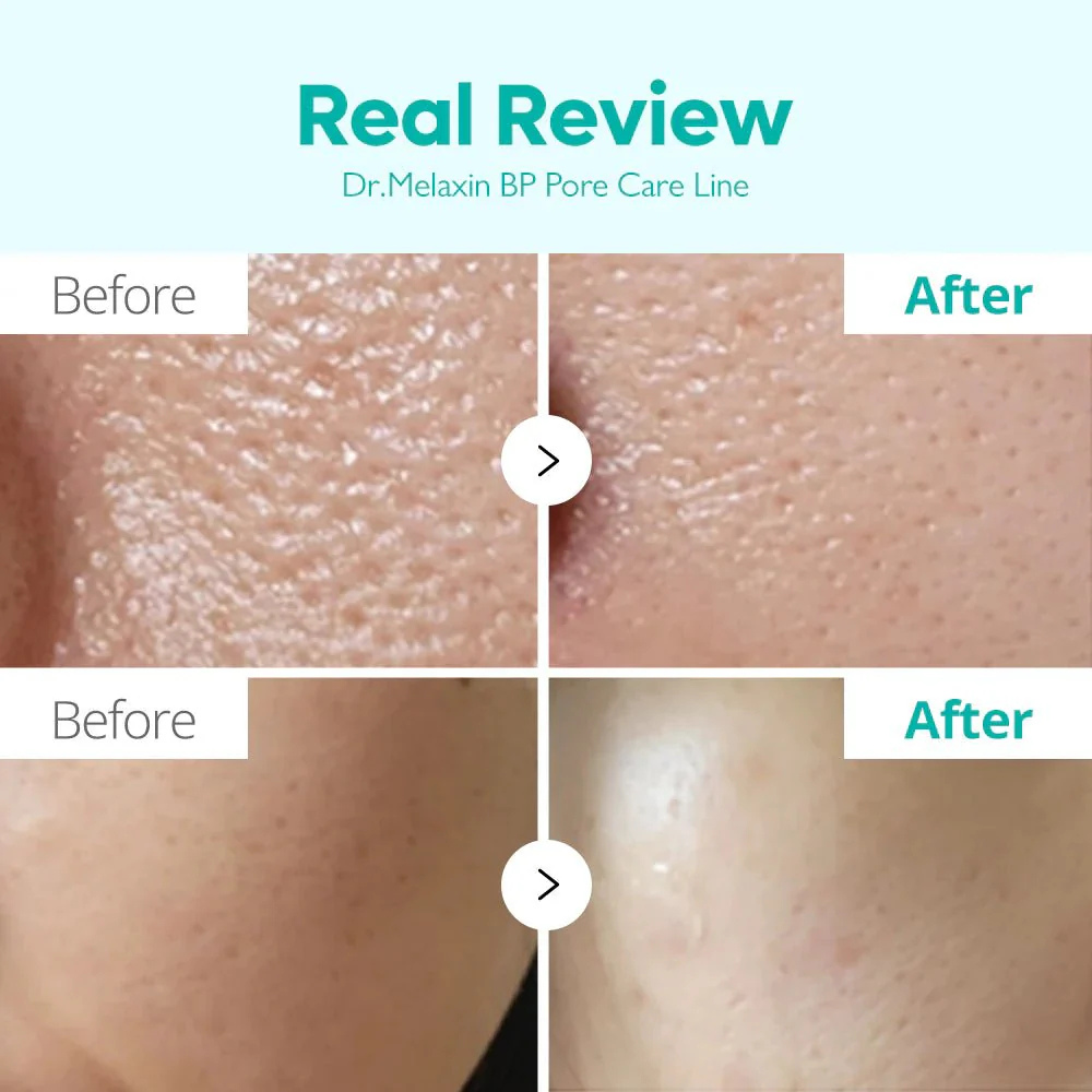 Dr.Melaxin BP Pore Barrier Cream