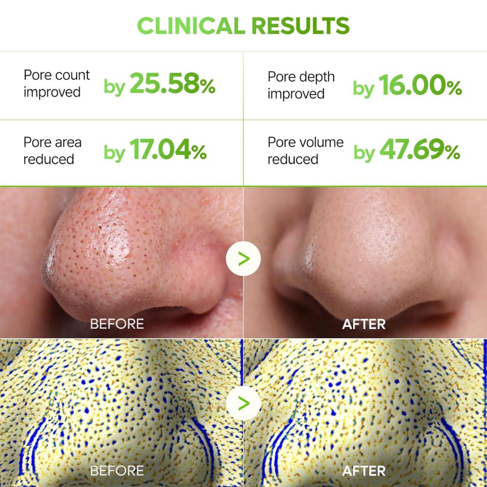Dr.Melaxin Cactox 3-Step Nose Pore Pack (3 copë)